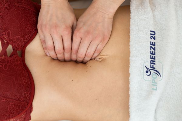 diastasis recti treatment Congleton