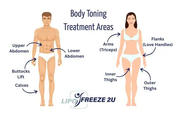 Graphic showing where you can have Body toning Treatment Congleton on your body