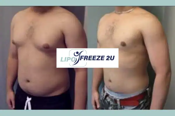 How Long Does It Take to See Results Congleton?