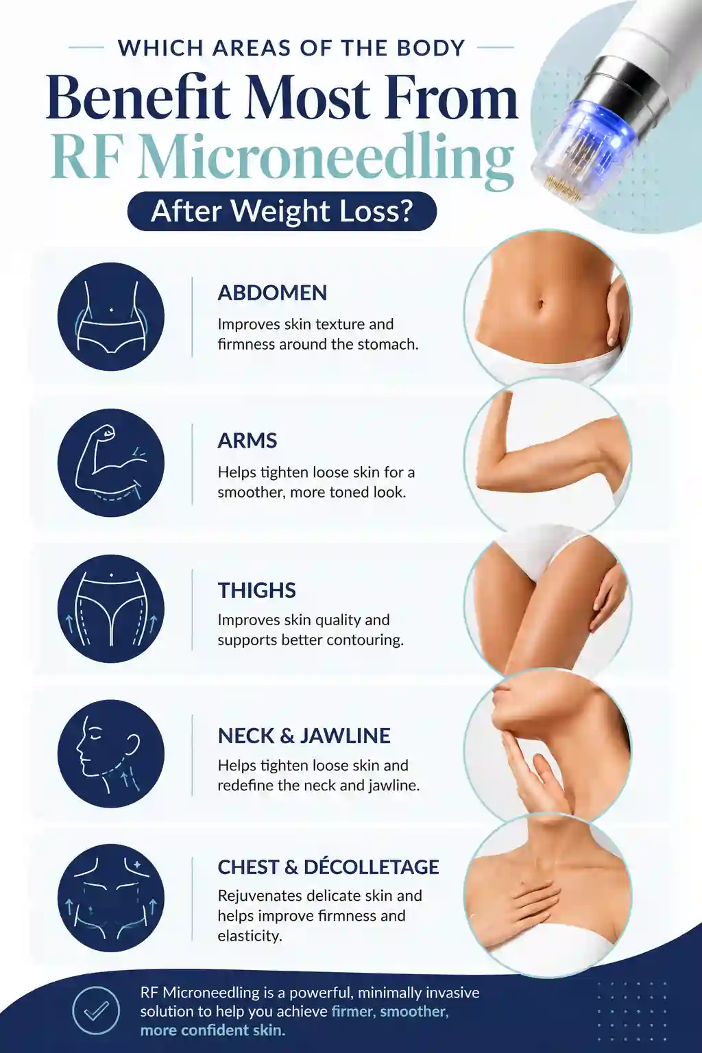 Which Areas of the Body Benefit Most From RF Microneedling After Weight Loss Congleton